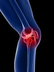 Zimmer NexGen Knee: severe complications